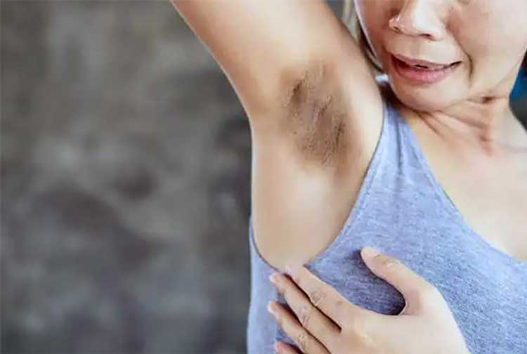 چه کسانی نباید لیزر انجام دهند؟