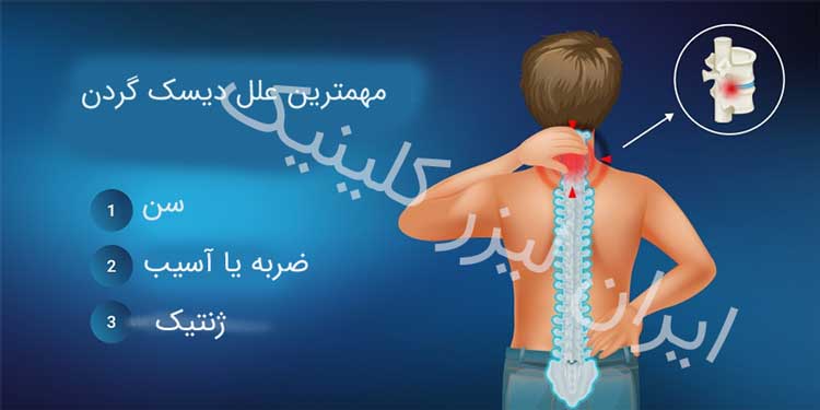 دیسک گردن
