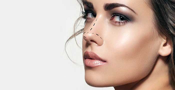 فرم دهی بینی گوشتی بدون جراحی با لیزر