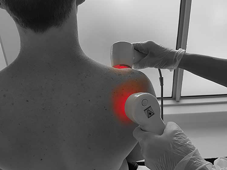 تاندون شانه پارگی تاندون شانه